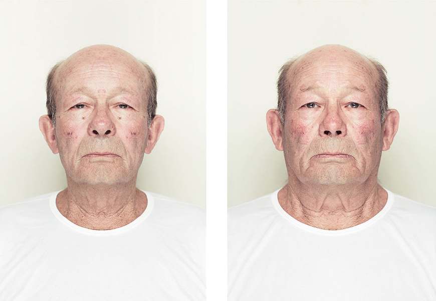 Основная симметрия как признак смерти и как можно ее определить обычному человеку: как меняется лицо, симптомы