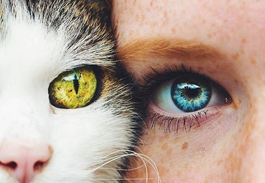 Взгляд как у кошки песня. Синдром Шмида-Фраккаро синдром кошачьего глаза.